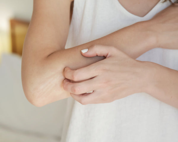 10 WAYS TO RESCUE ITCHY, WINTER SKIN